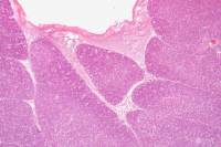 Thymus jeune x25